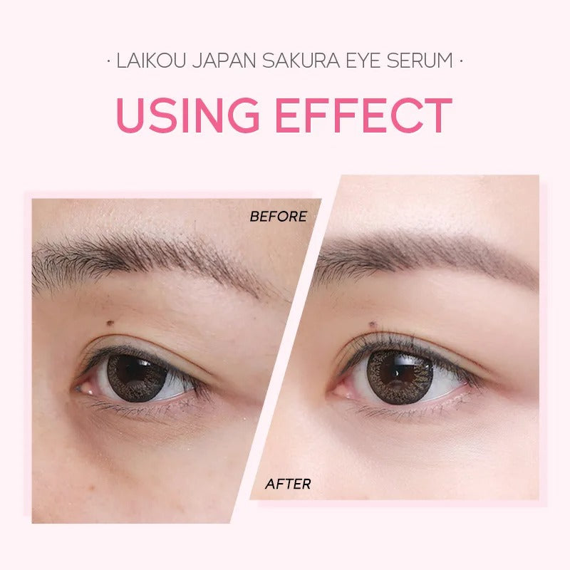 Sakura Eye Serum with Roller Applicator – 15ml product image by VitalHarbour